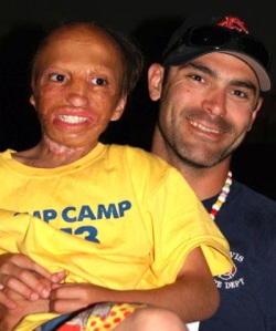 Photo: AARBF.org, Isaiah with camp counselor 